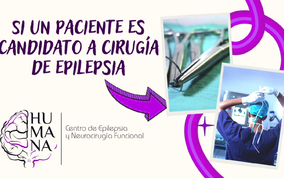 “Cirugía de Epilepsia, esto es lo que debes conocer”