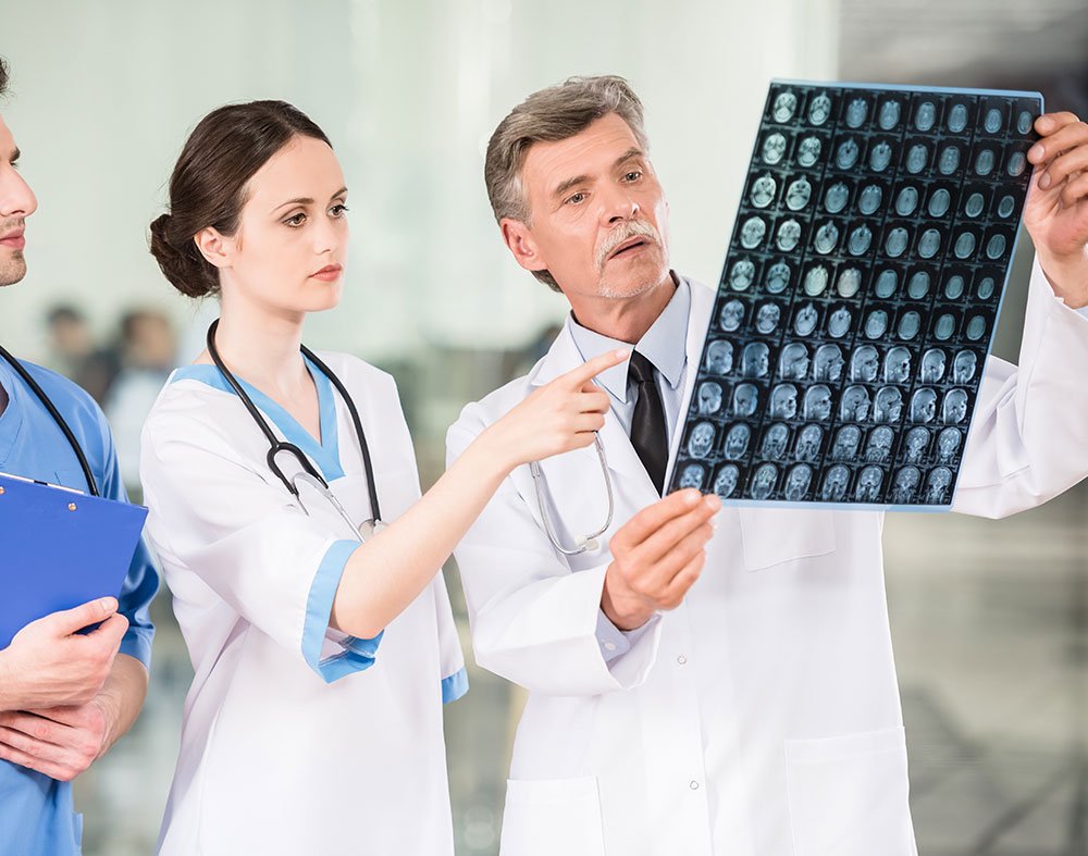 epilepsia tratamiento